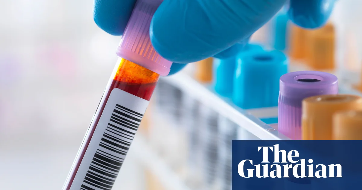 Scientists Unveil First Reliable Blood Test for Chronic Fatigue Syndrome—A Win for Society and Youth Wellness