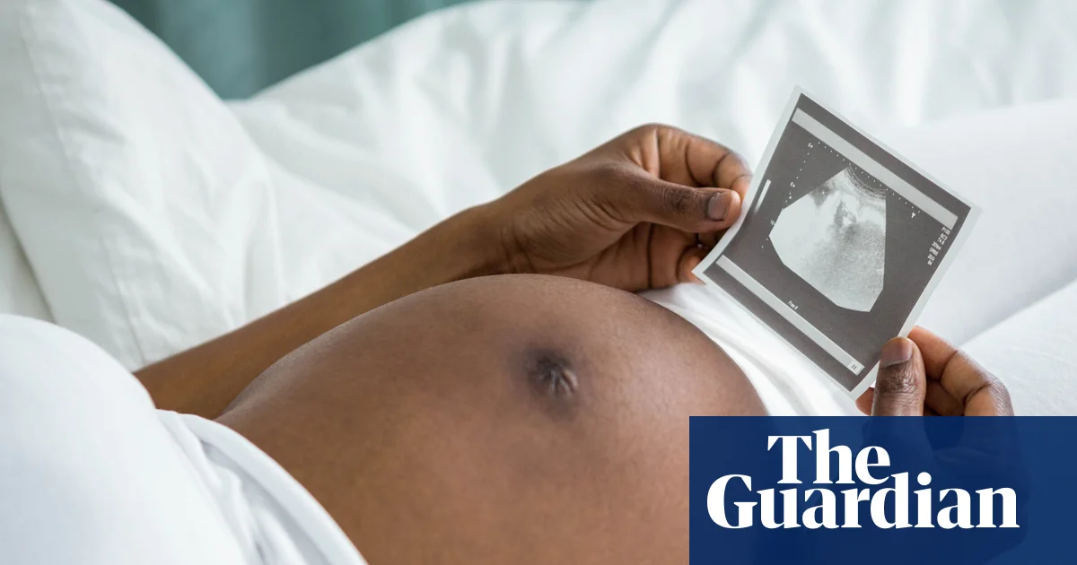 Study suggests racial stress may be fueling higher maternal death rates among Black women